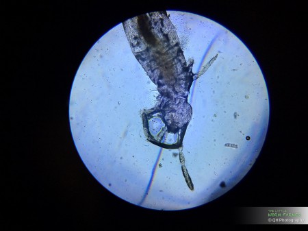 a springtail got caught in the AACT sample